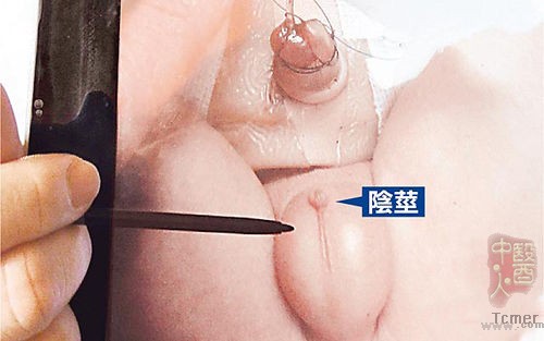 台湾男婴受塑化剂影响生殖器不到正常1/10