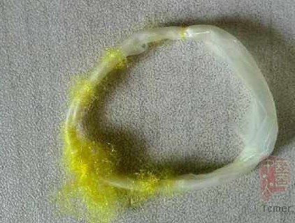重庆现“避孕套橡皮筋” 专家:别用嘴咬(图)