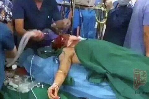 ҽ���������沿����������ͼƬ��Դ����