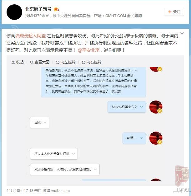 网络红人“烧伤医生阿宝”疑似被患者咬伤 网络红人“烧伤医生阿宝”疑似被患者咬伤