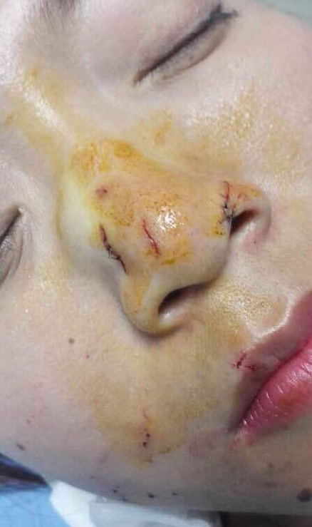 被咬游客
