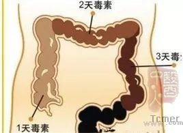 女子喝通便茶排毒养颜,四年后致肠子变黑
