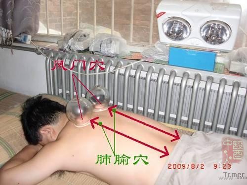 ͼ����ҽ�ι����Ƹ�ð�����׾��߹�