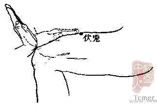 Ѫ�ܶ���70%��ҽ��1������Ѩ�����������һ�������������
