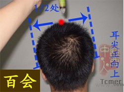 颈椎病的艾灸疗法