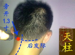 颈椎病的艾灸疗法