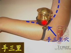 颈椎病的艾灸疗法