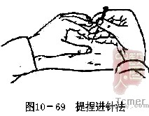 提捏进针法