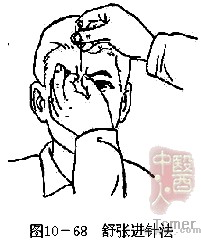 舒张进针法