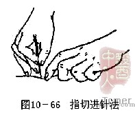 指切进针法