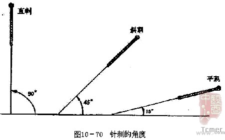 针刺的角度